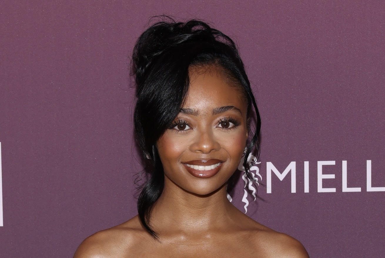 Skai Jackson Talks Struggle With Postpartum Hair Loss